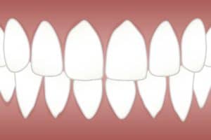 שיניים קדמיות
